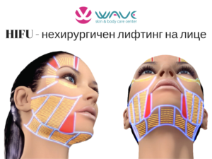HIFU лифтинг